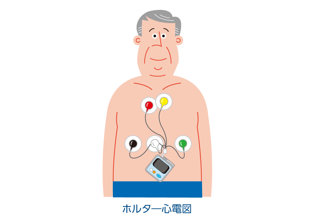 失神 | 長時間心電図