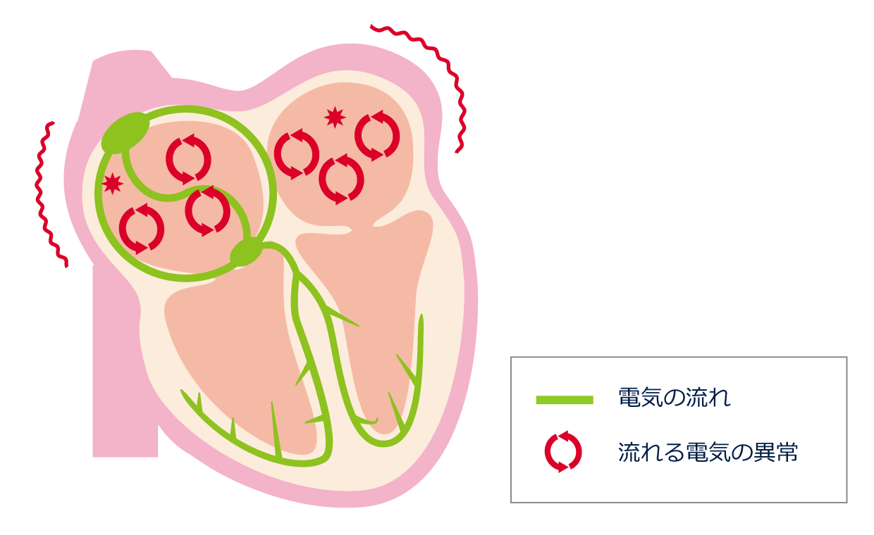 失神 | 心房細動